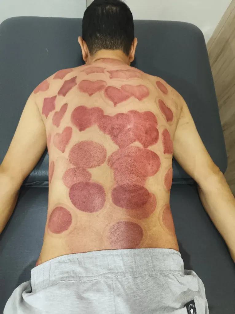 TheraCure Clinic by Dr Pooja Mehta | Best Physiotherapist in Mumbai
