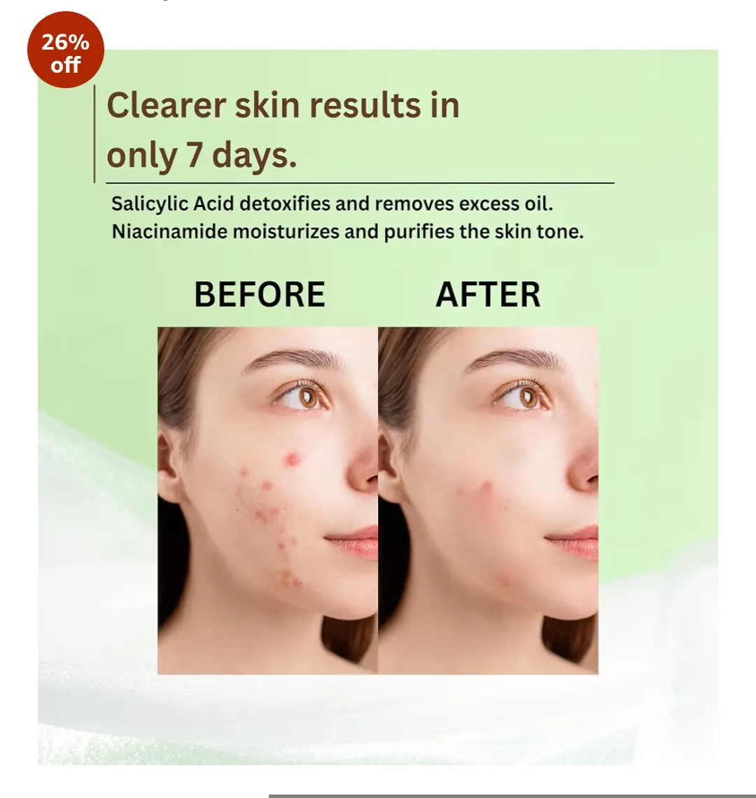 Ciramist Acne & Acne marks Remove Face wash With Niacinamide, Salicylic Acid & Tea Tree Oil 100ml Bottle