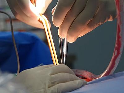 Oncology and Oncosurgery Department in Ahmedabad