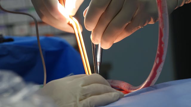 Oncology and Oncosurgery Department in Ahmedabad