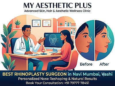 Best Rhinoplasty Surgeon in Navi Mumbai, Vashi | My Aesthetic Plus