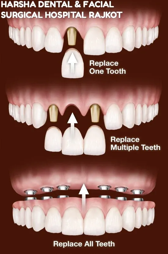 Harsha Dental and Facial Surgical Hospital